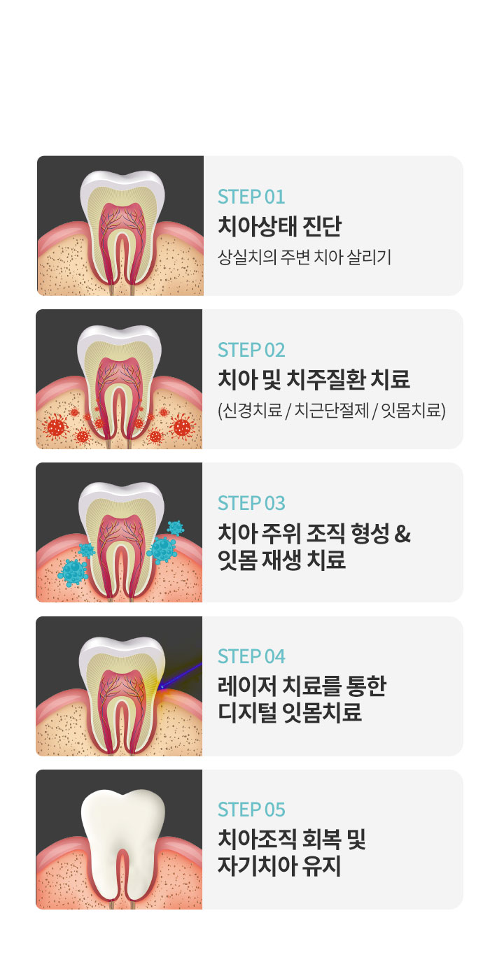 자기치아 살리기