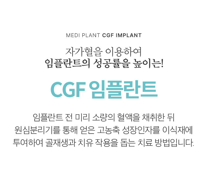 CGF 임플란트