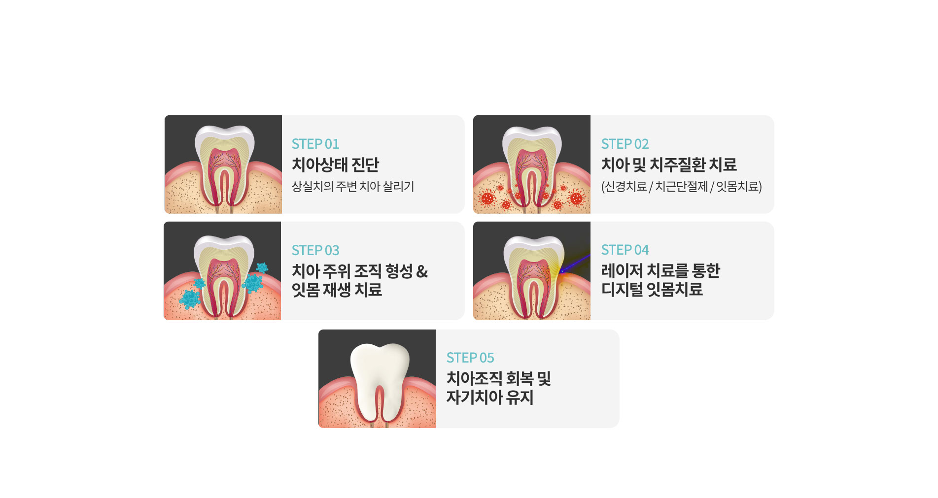 자기치아 살리기