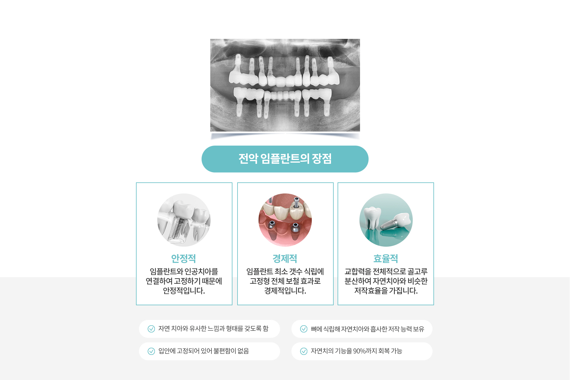 전악 임플란트