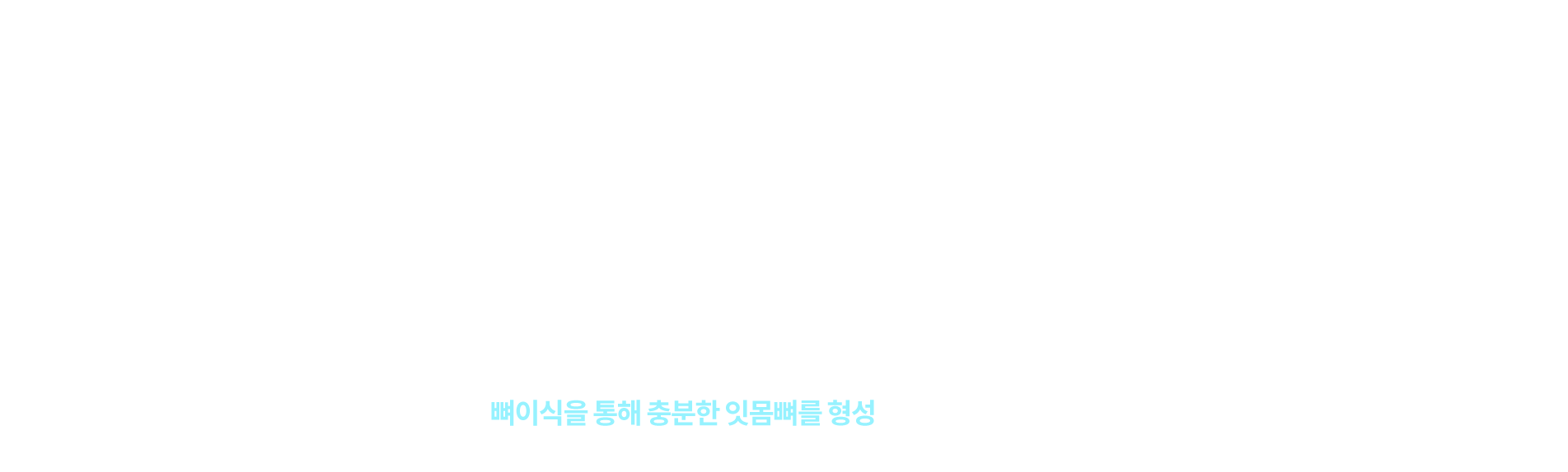 잇몸뼈이식