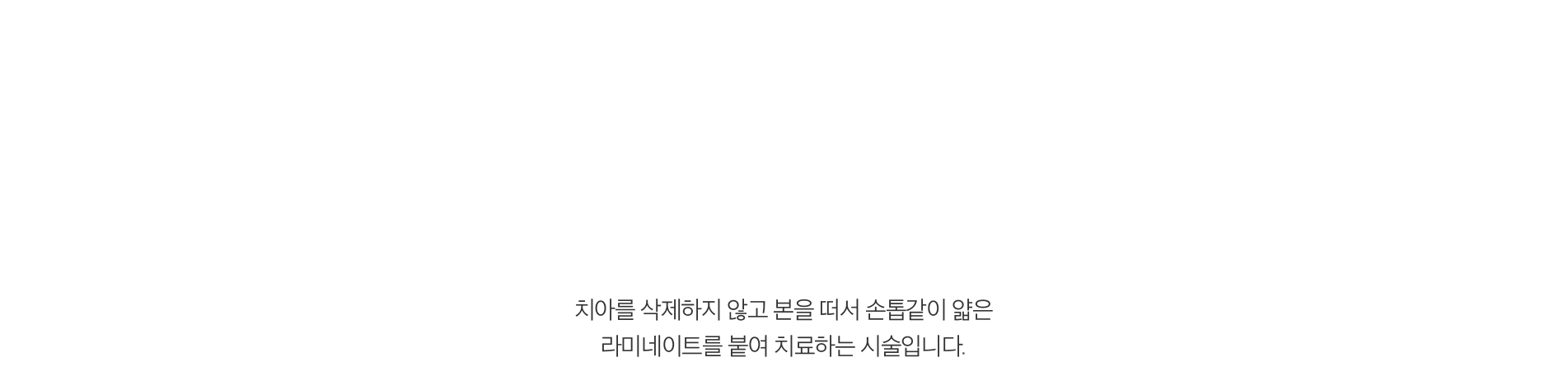 라미네이트