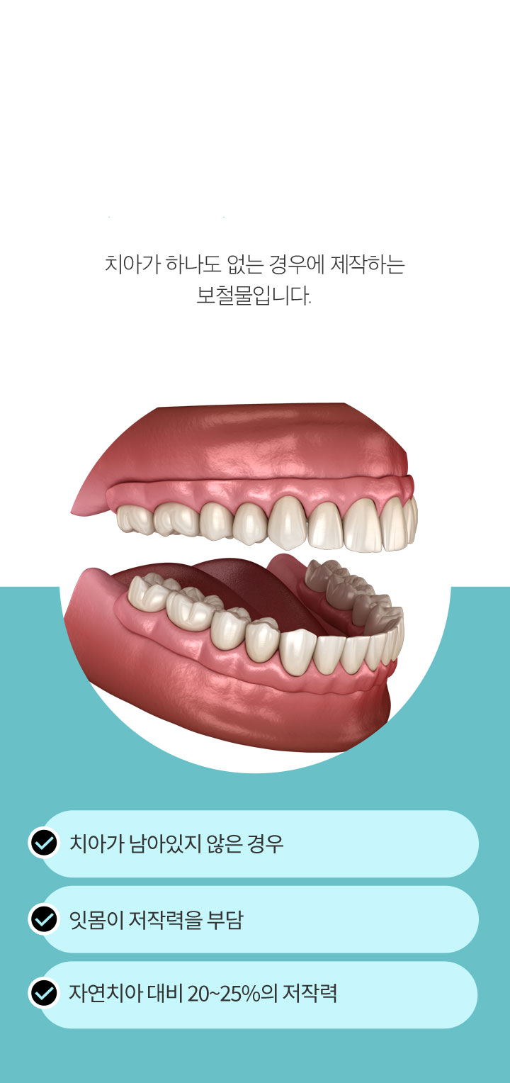 두 번째, 완전 틀니