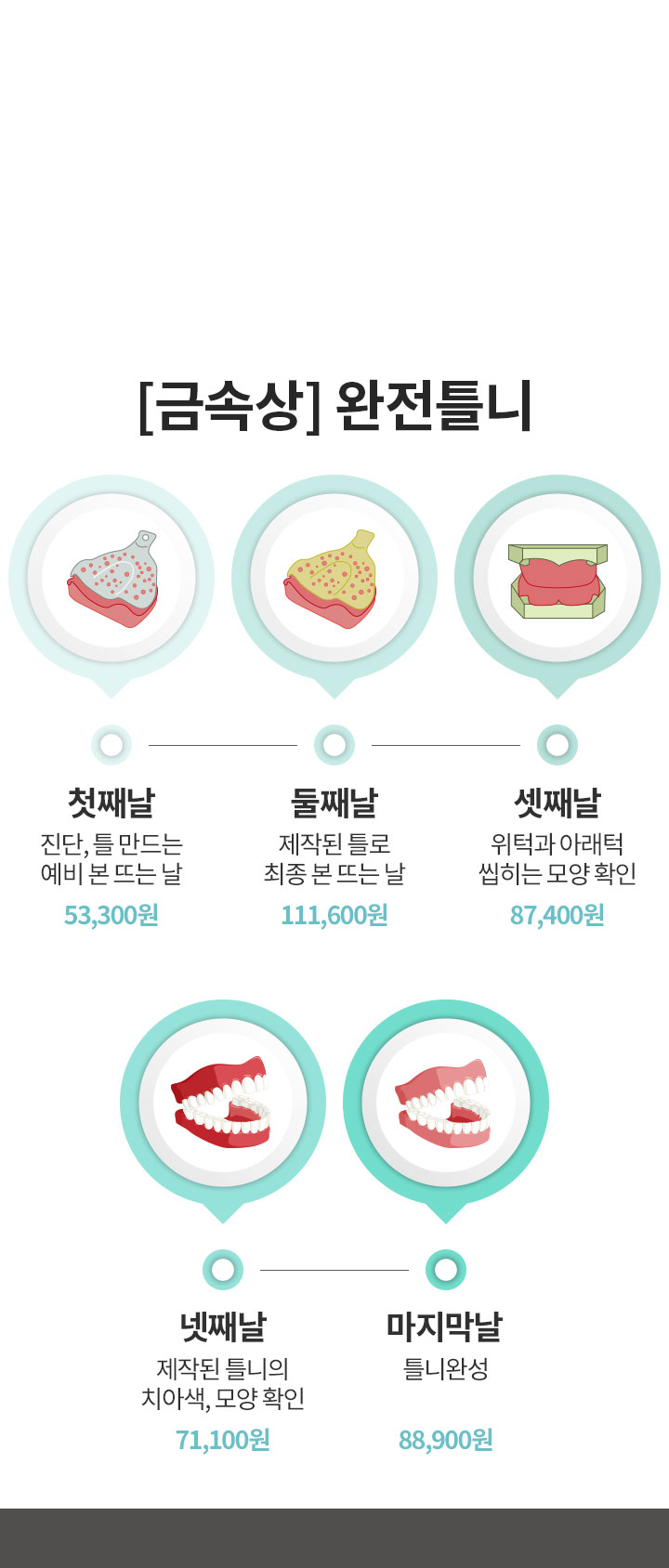 보험 틀니 시술 절차 및 안내