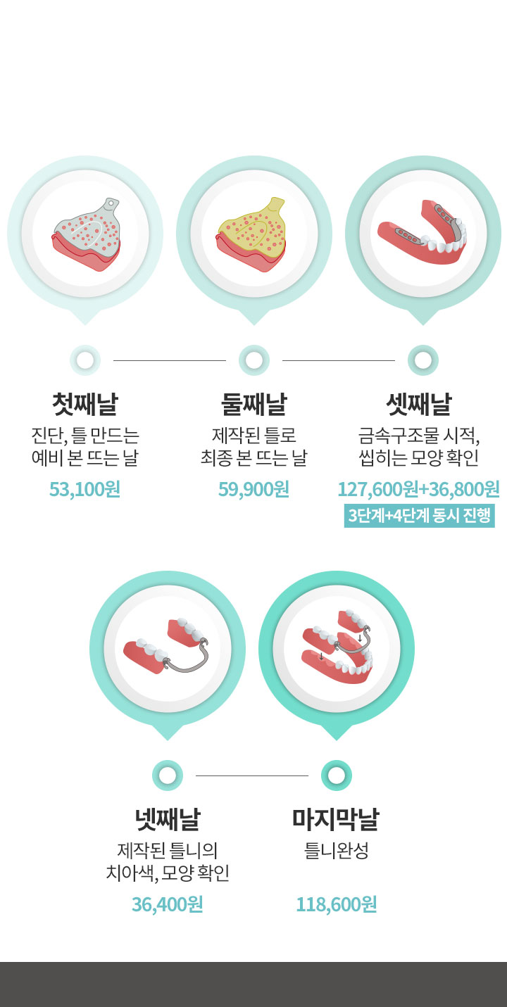 부분틀니