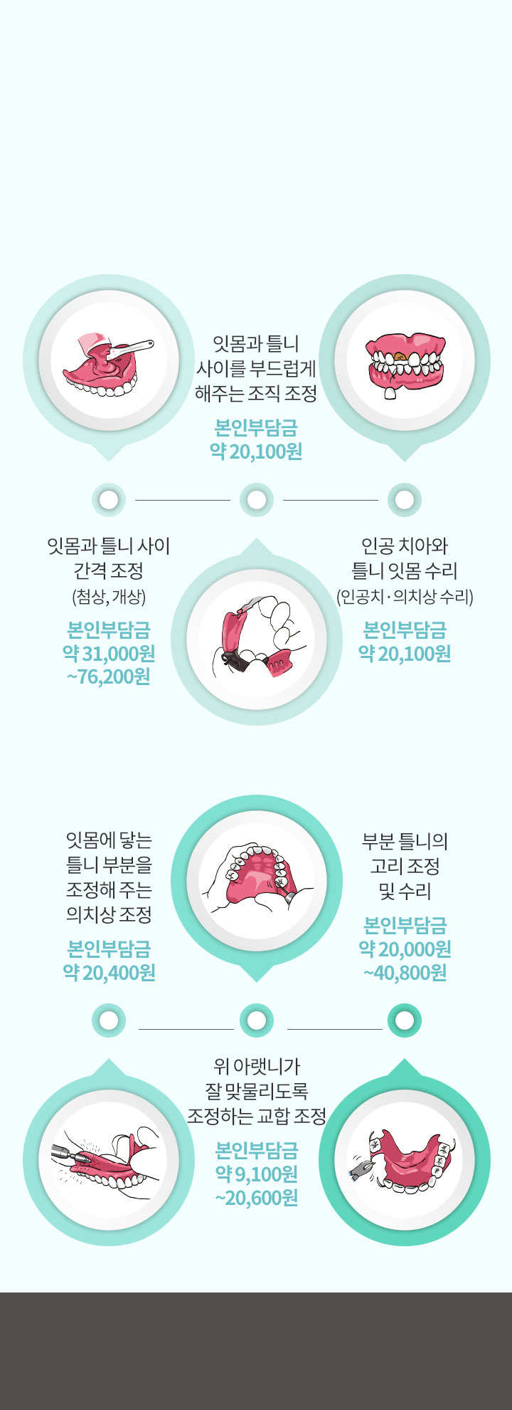보험 틀니 수리 종류 및 안내