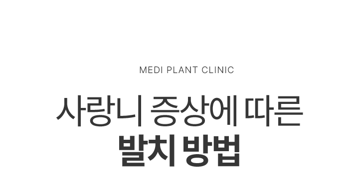 사랑니 증상에 따른 발치 방법