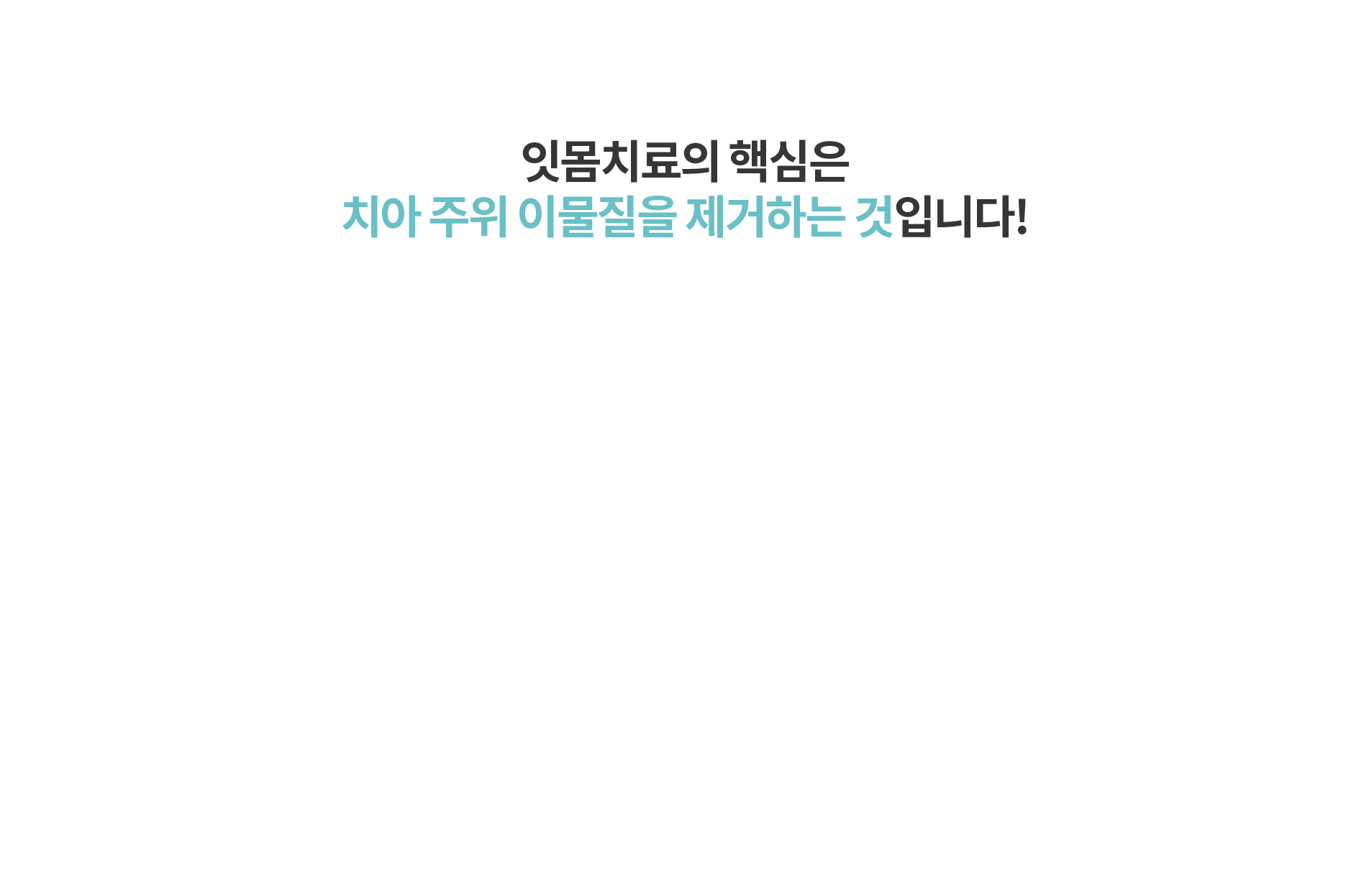 잇몸치료의 핵심은 치아 주위 이물질을 제거하는 것입니다!