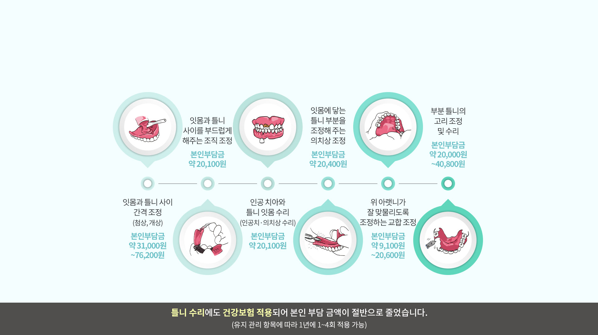 부분틀니