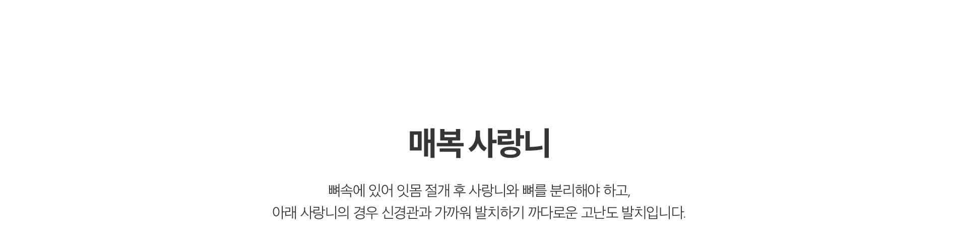 매복 사랑니