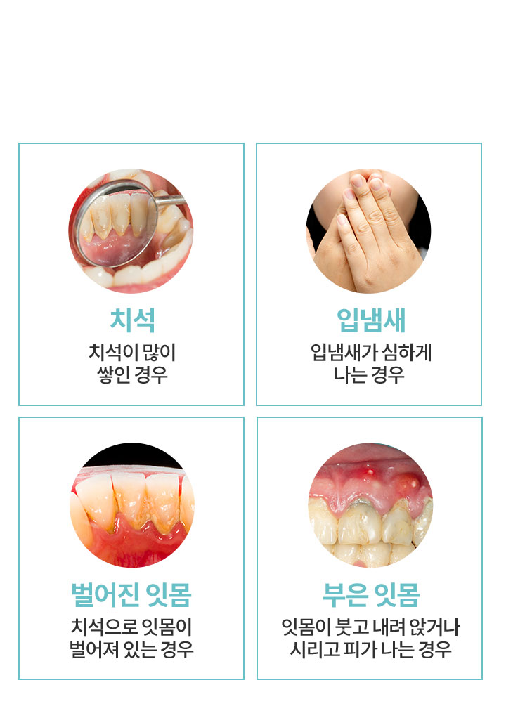 스케일링 필수 추천 대상